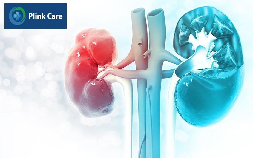 suy thận mạn giai đoạn cuối