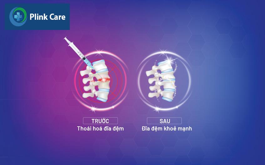 tiêm steroid ngoài màng cứng