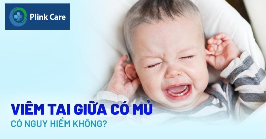 bệnh viêm tai giữa ứ mũ