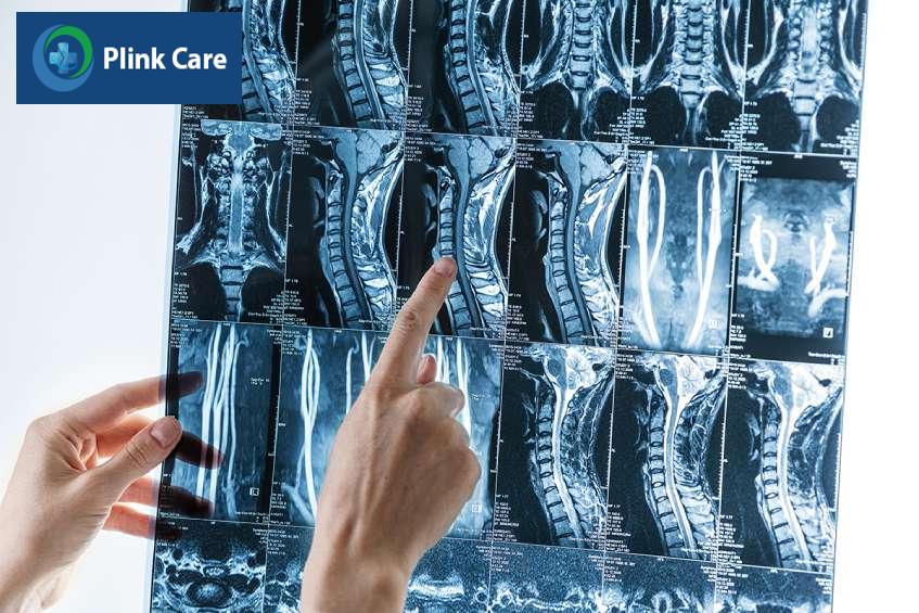 chỉ định chụp mri cột sống thắt lưng