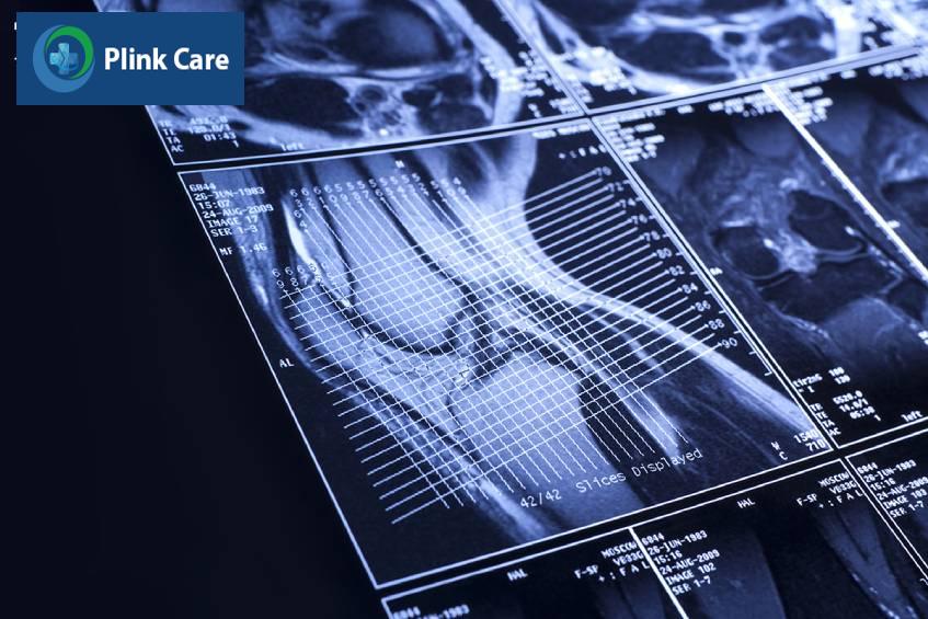 chi phí mri khớp gối