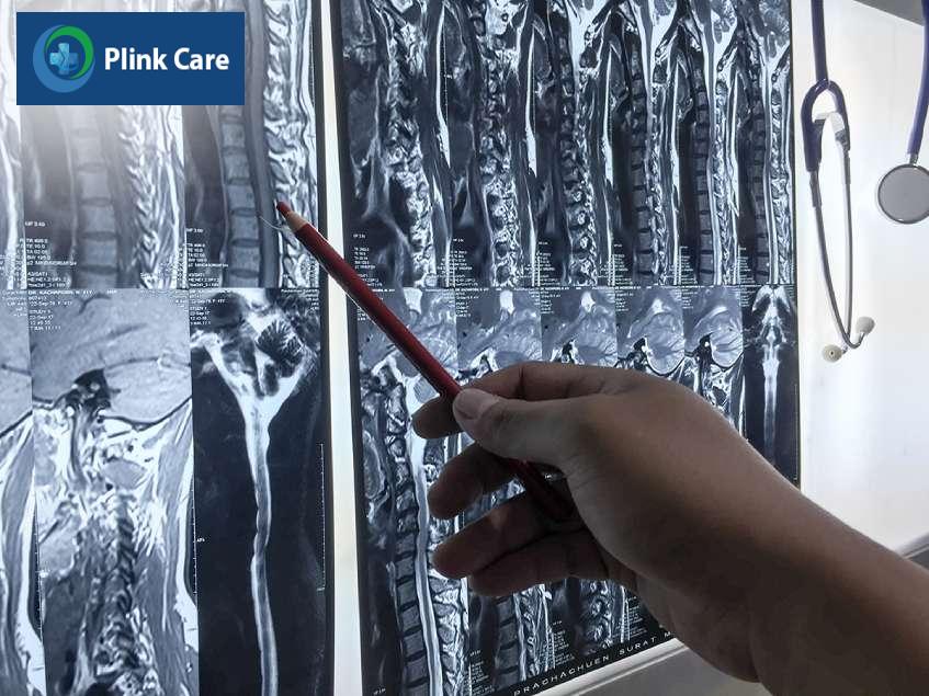 chụp mri cột sống thắt lưng chẩn đoán bệnh gì