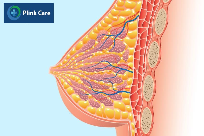 Dấu hiệu và phân loại mô vú dày đặc