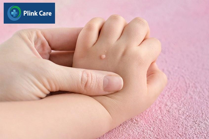 hệ thống miễn dịch suy yếu