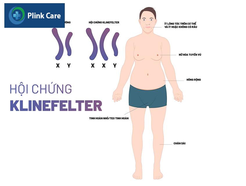 hội chứng klinerfelter