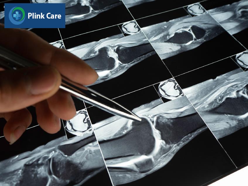 khi nào cần mri khớp gối