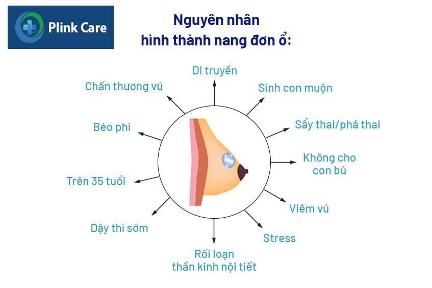 Nguyên nhân gây nang vú