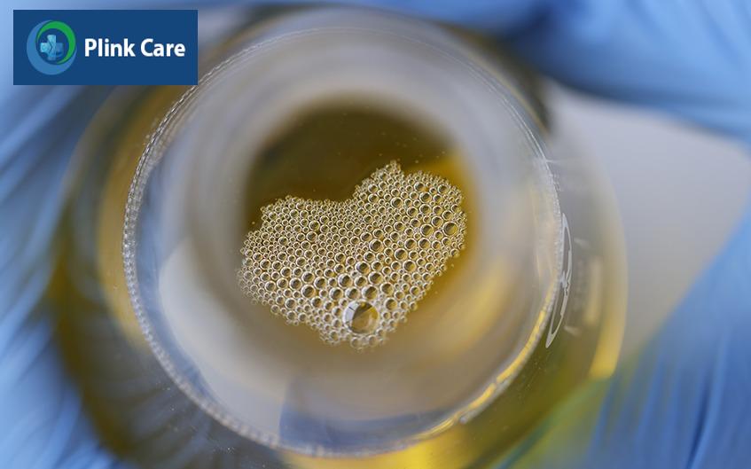 triệu chứng có protein trong nước tiểu