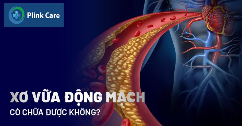 xơ vữa động mạch có chữa được không