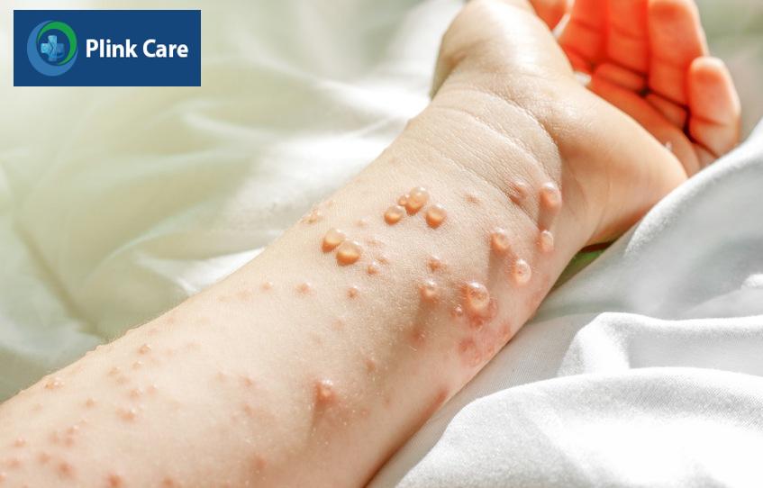 Bệnh có thể gây ra nhiều biến chứng nguy hiểm