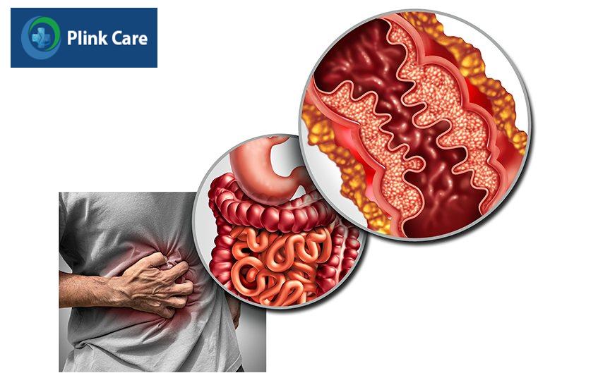 bị viêm đường ruột điều trị sao