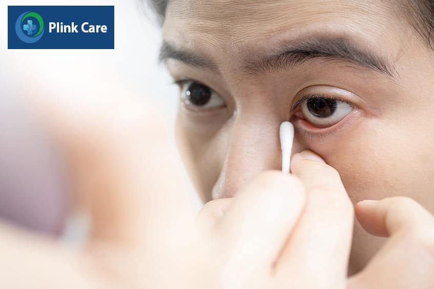 Hướng dẫn cách lấy dị vật trong mắt ra ngay tại nhà