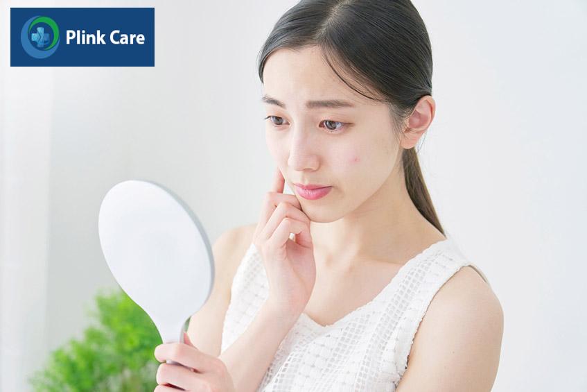 cấy que dễ bị nổi mụn