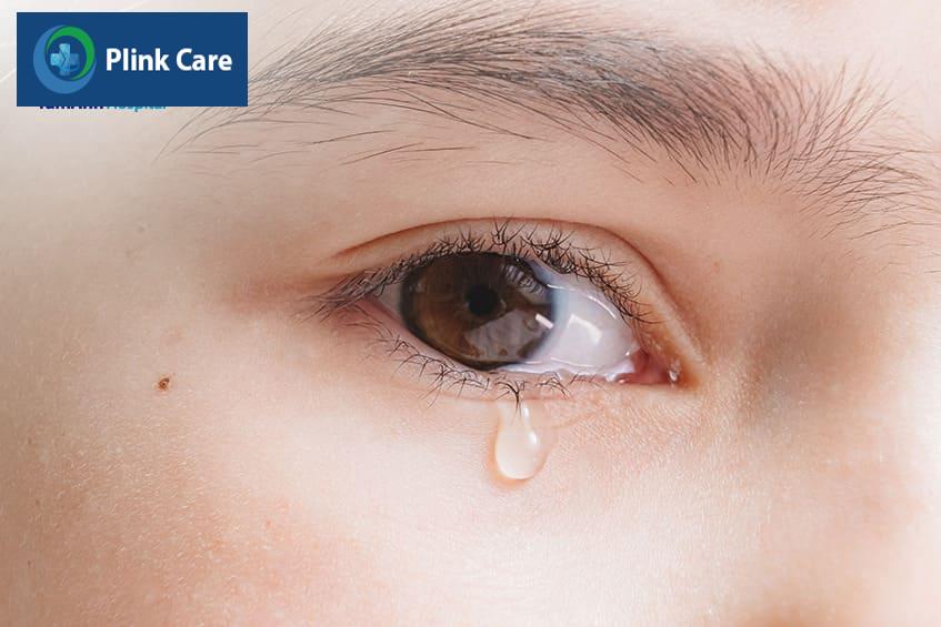chẩn đoán viêm bờ mi mắt dưới