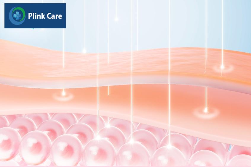 laser pico hoạt động
