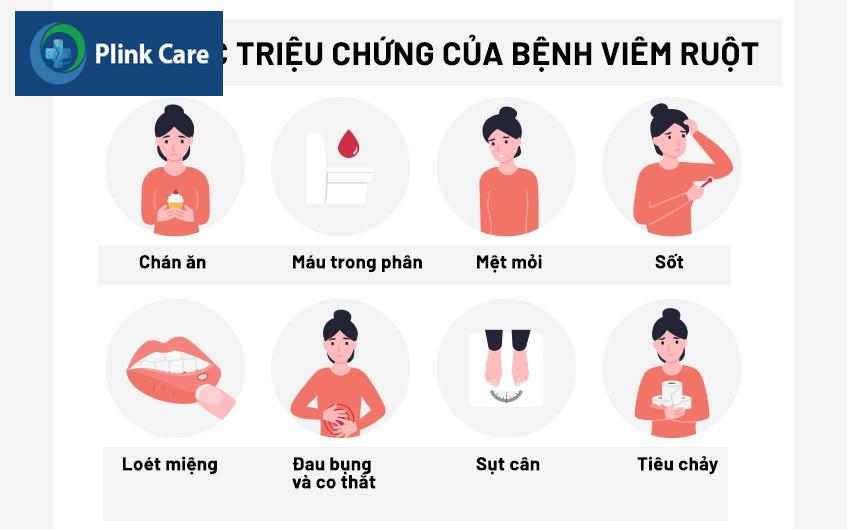 dấu hiệu bệnh crohn
