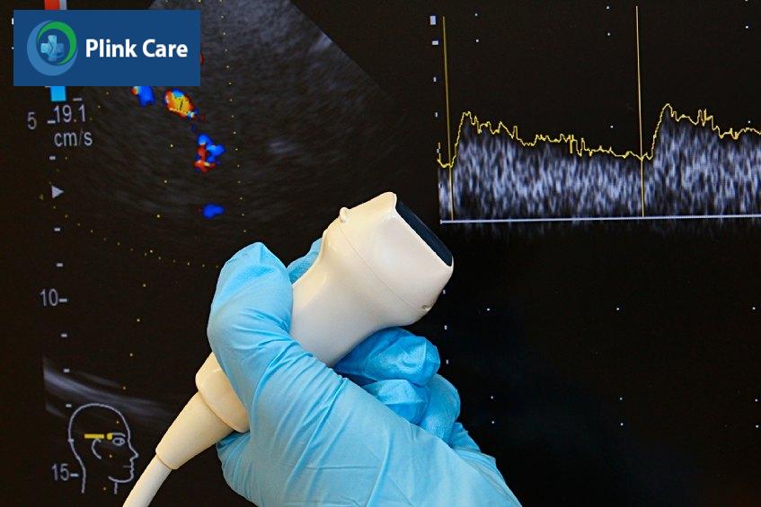 đối tượng được chỉ định siêu âm doppler xuyên sọ