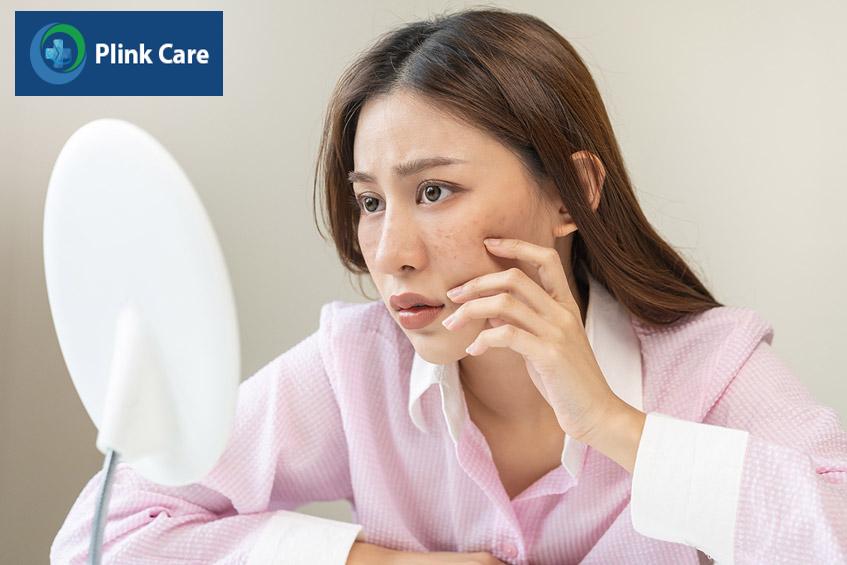 gặp phải một số vấn đề ở da