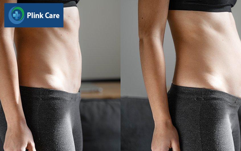 hay bị chướng bụng đầy hơi