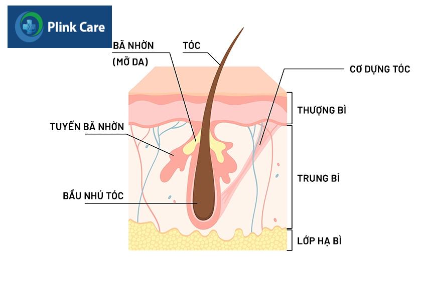 nguyên nhân hói đầu ở nữ