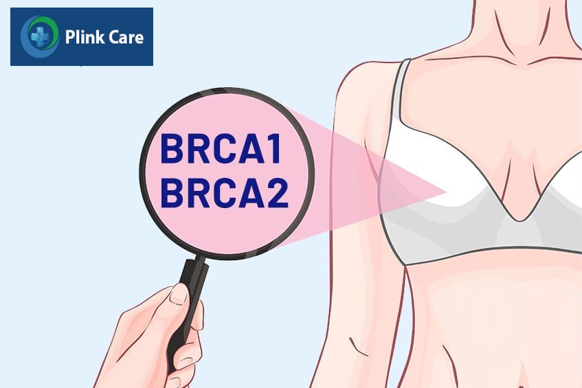 Những lưu ý khi xét nghiệm BRCA