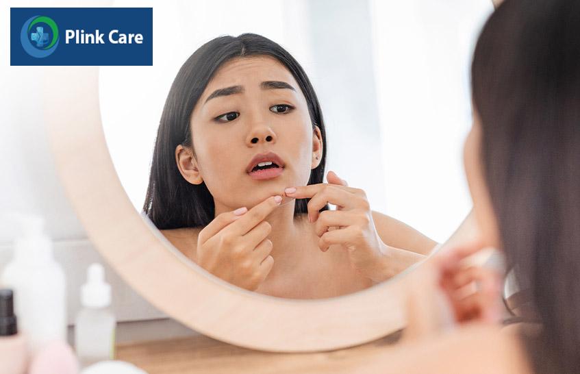 nổi mụn trong giai đoạn hành kinh