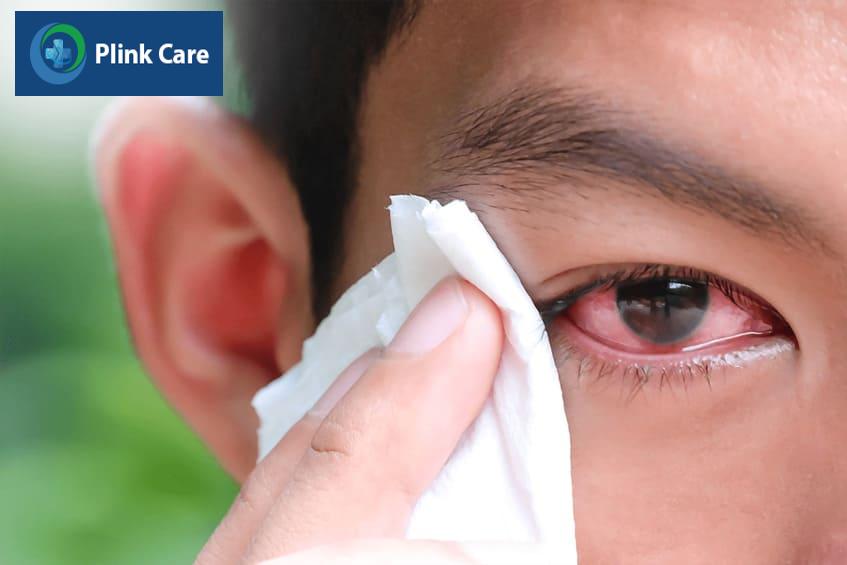 Triệu chứng bệnh viêm kết mạc