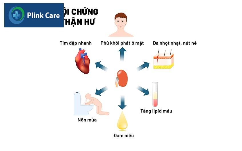 triệu chứng của hội chứng thận hư
