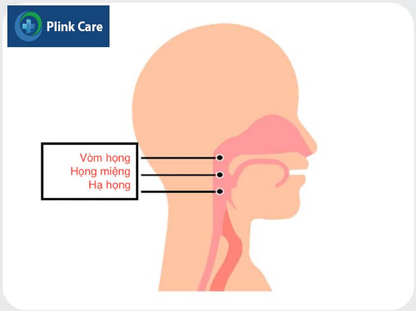 trị trí vòm họng dấu hiệu ung thư