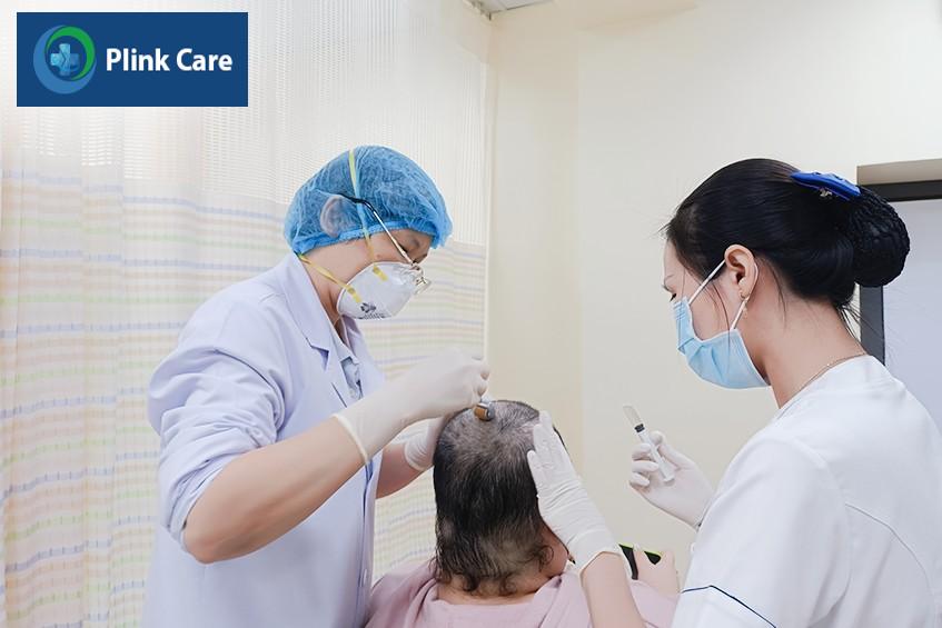 biện pháp giảm thiểu tình trạng hói đầu