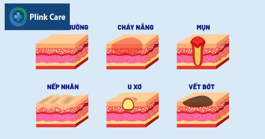 Các dạng tổn thương da thường gặp.