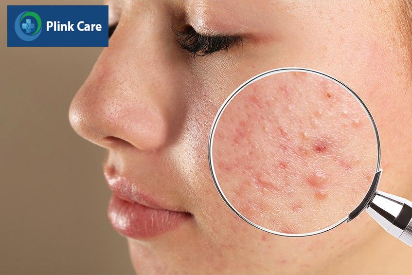 Chăm sóc đúng cách trong quá trình điều trị