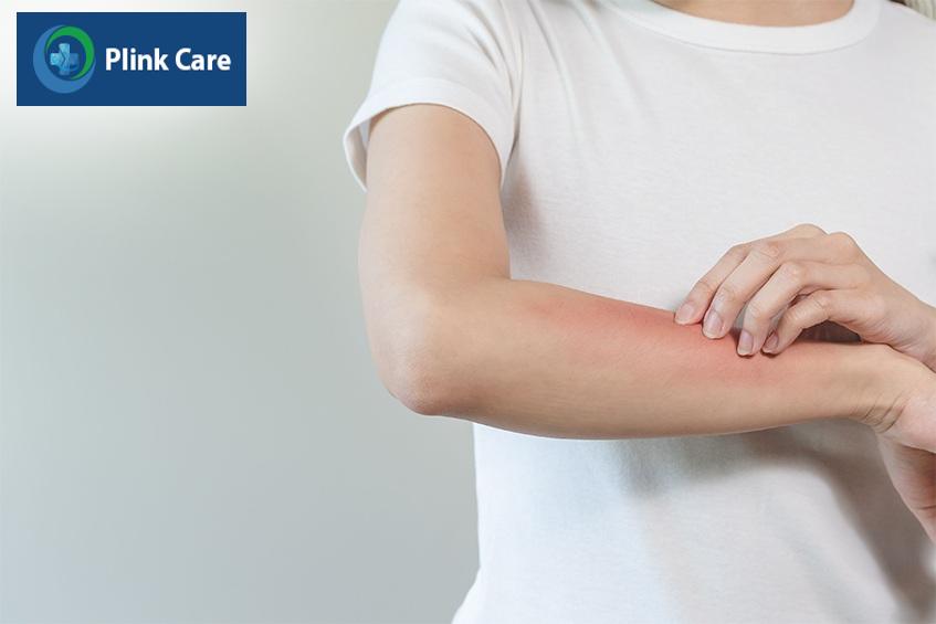 dị ứng thời tiết bao lâu thì khỏi
