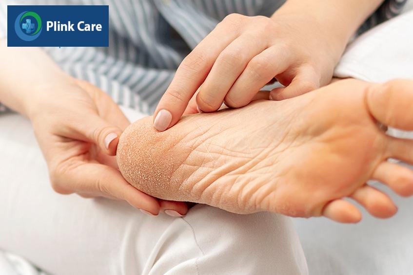 Kiểm tra bàn chân thường xuyên thành thói quen hàng ngày