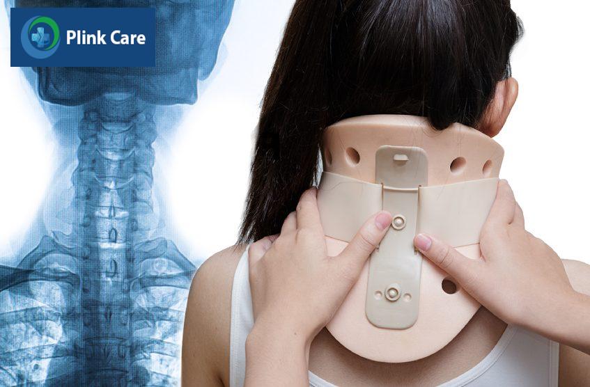 kỹ thuật chụp x quang cột sống cổ
