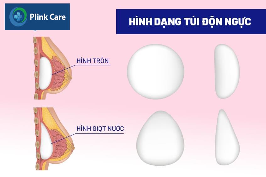 phương pháp thay túi ngực