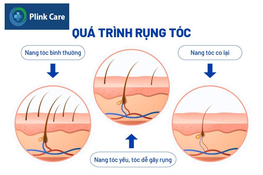 quá trình rụng tóc