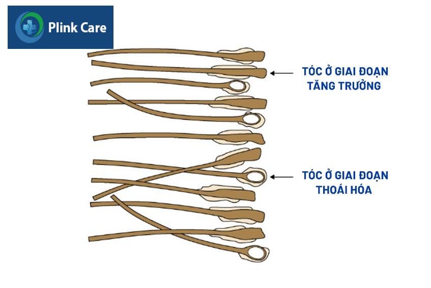 rụng tóc ở nam giới diễn ra như thế nào