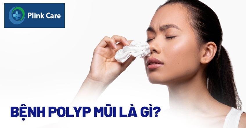 bệnh polyp mũi
