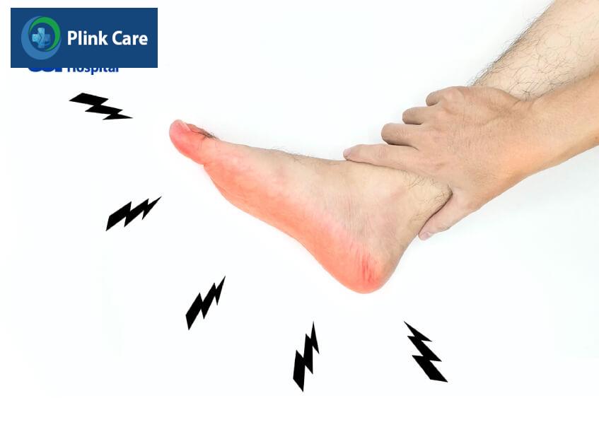 bệnh viêm dây thần kinh