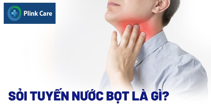 bị sỏi tuyến nước bọt