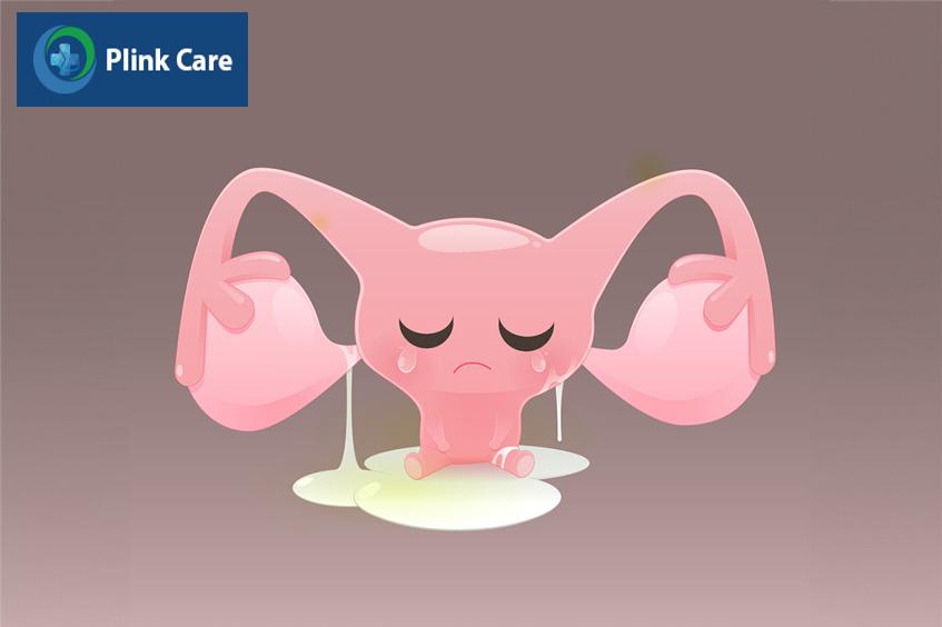cần đi khám ngay nếu khí hư có mùi hôi
