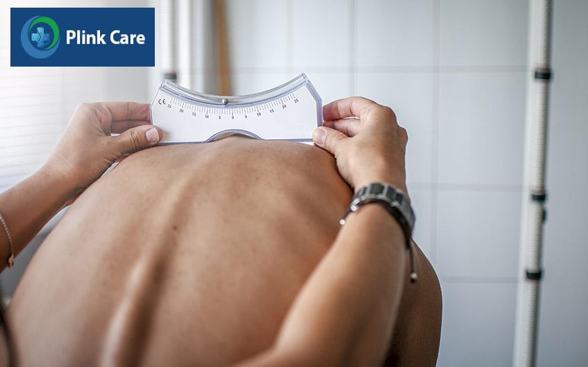 chẩn đoán tình trạng cong cột sống