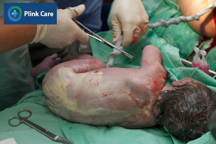 chi phí lưu trữ tế bào gốc máu cuống rốn