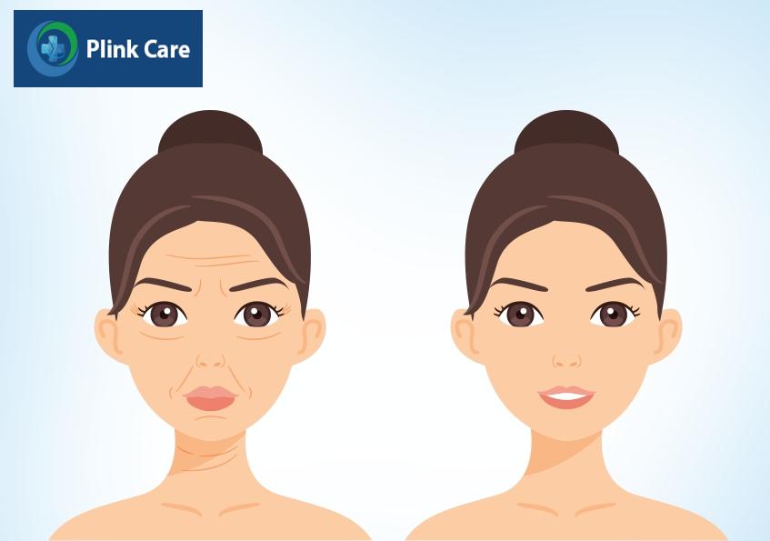 chống chỉ định tiêm filler ở má