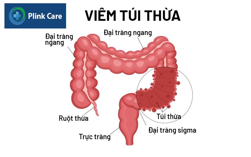 nguyên nhân gây đau bụng trên rốn