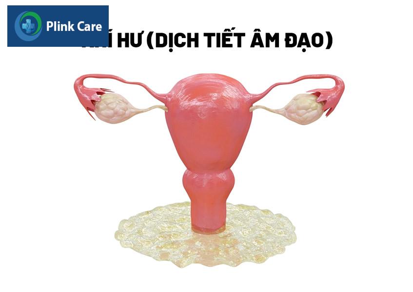 khí hư thường có màu như lòng trắng trứng