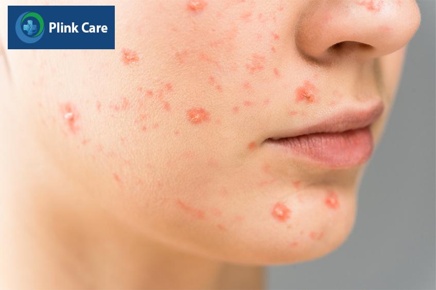 Không nên sử dụng mỹ phẩm, thuốc không rõ thành phần