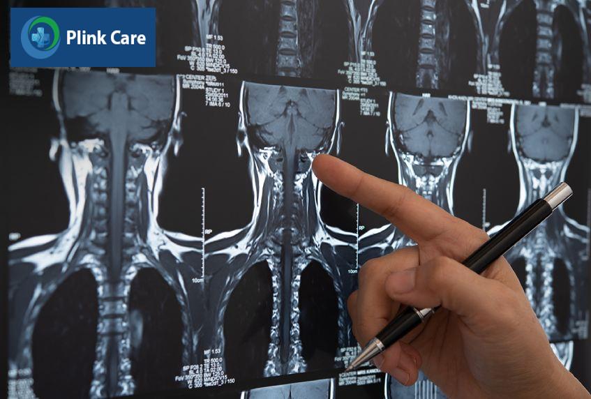 kỹ thuật chụp mri cột sống