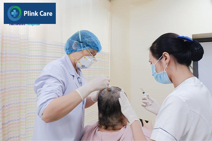 lưu ý khi điều trị hói đầu